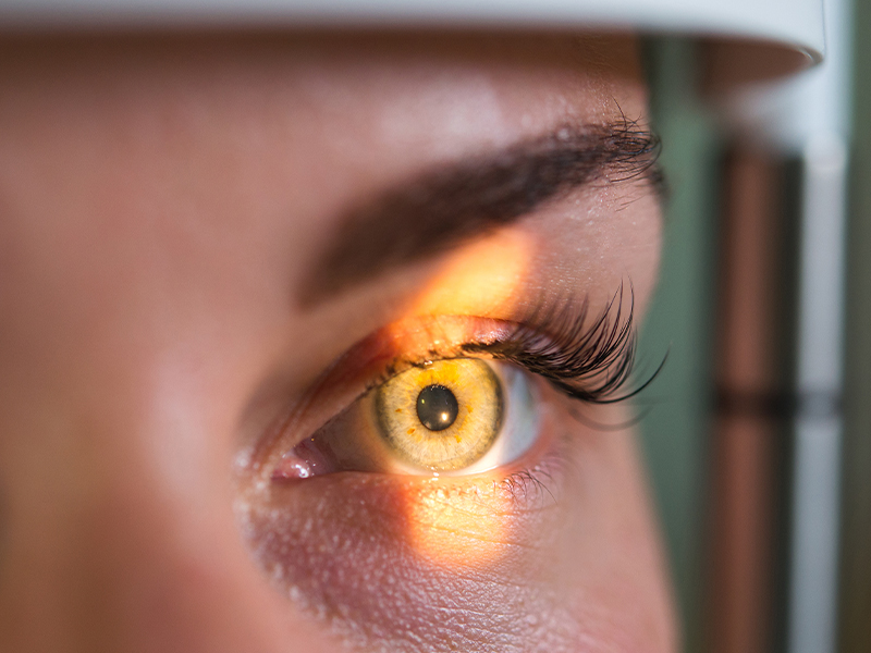 Cataract Surgery Co-Management Bronx